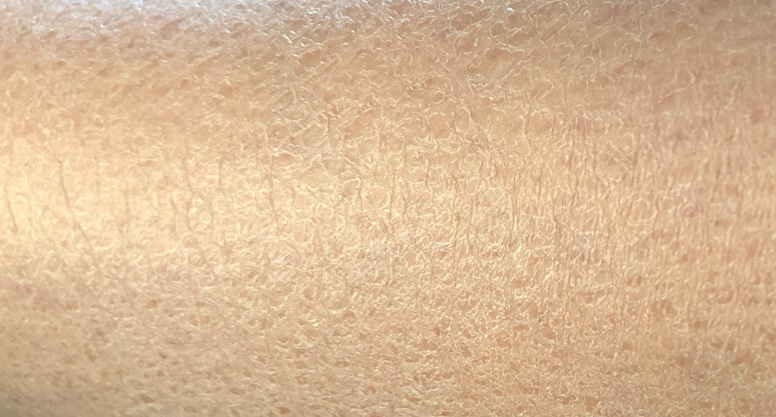 Pelle secca rimedi BeOnMe